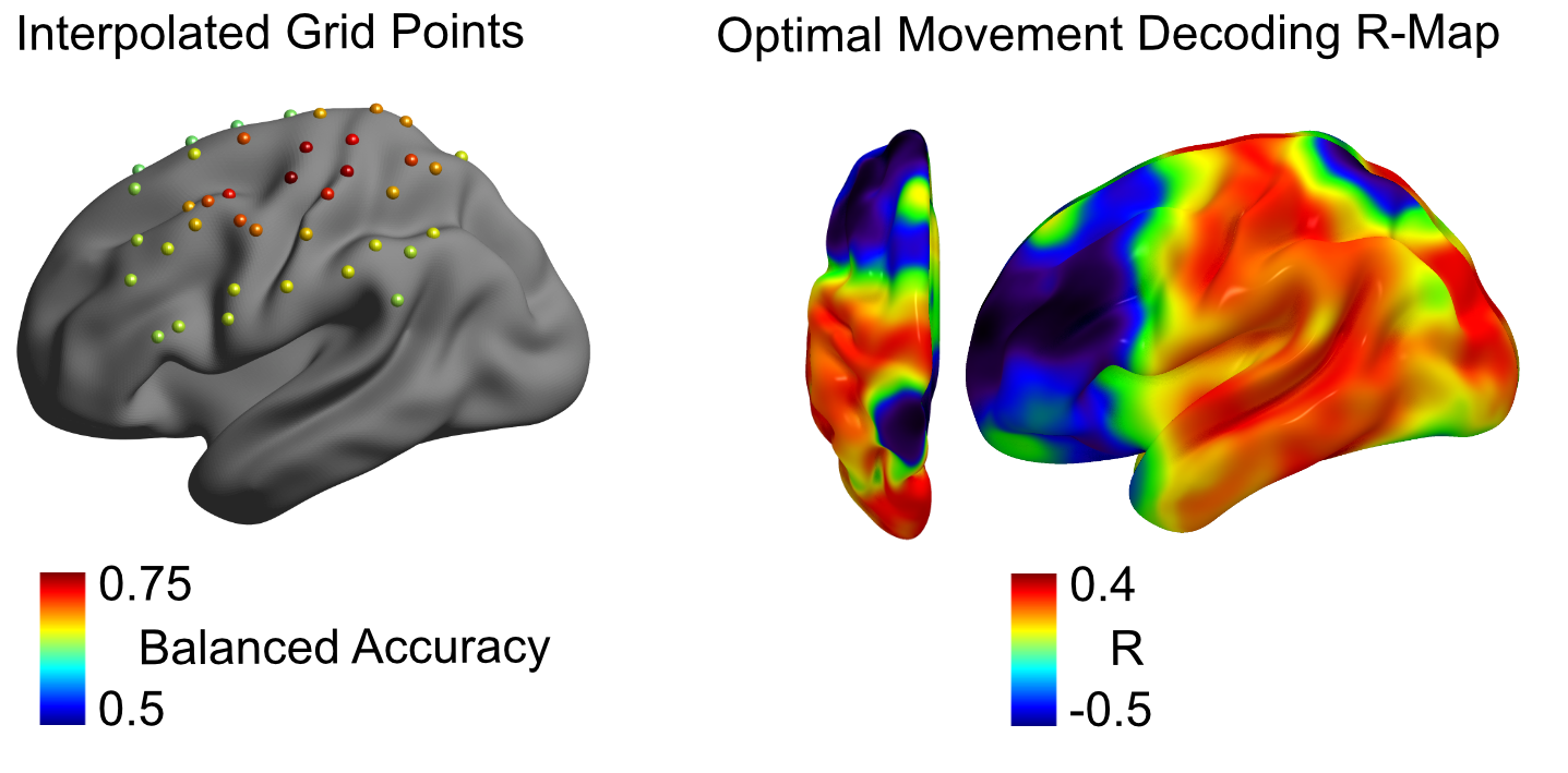 R-Map and grid point approach for decoding without patient-individual training