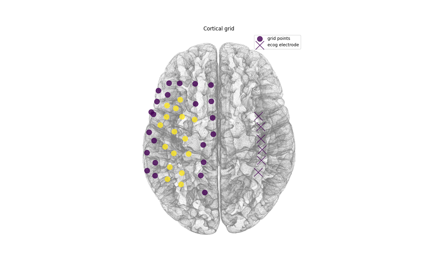 Cortical grid