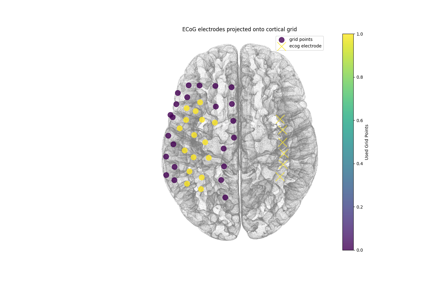 ECoG electrodes projected onto cortical grid